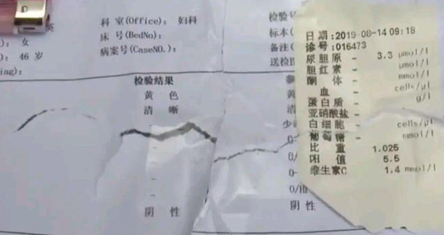 一女子妇科检查后发现身体有异样，去卫生间检查，结果是塑料套子