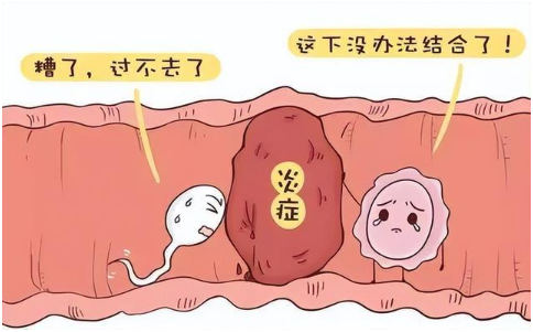 女子不孕,胞脉瘀阻!一张方子,分清浊,通胞络,助好孕