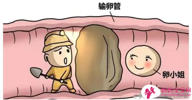 为何越来越多女性不孕不育 原因原来有这些