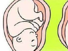 分娩方法
