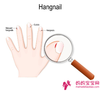 手指头脱皮长「倒刺」怎么办？皮肤科医生揭晓「指甲倒刺」原因！