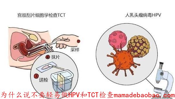 为什么说不要轻易做HPV和TCT检查