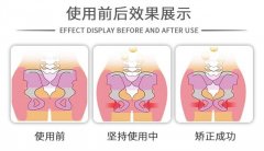 产后恢复 这些私处的护理必不可少