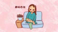 孕期腿上的青筋越来越明显 是不是静脉曲张（有可能）