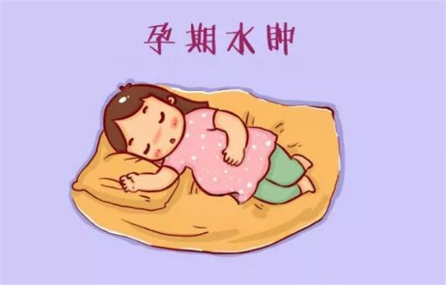 可以缓解产前水肿和腰痛的小妙招（热敷、休息、按摩、适当运动）