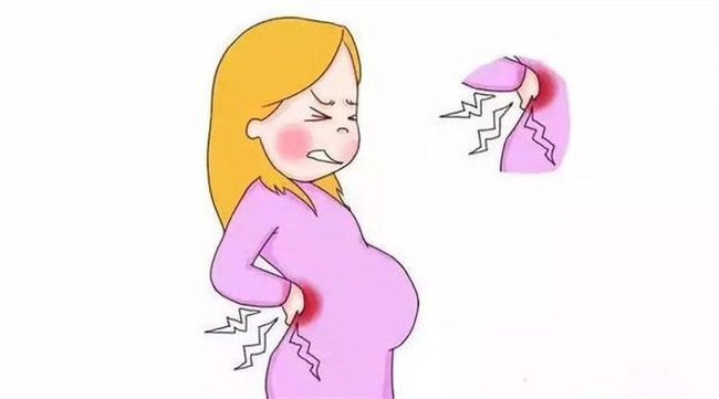可以缓解产前水肿和腰痛的小妙招（热敷、休息、按摩、适当运动）