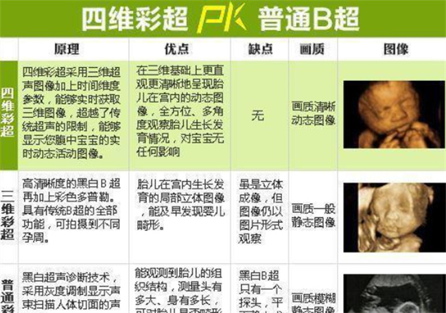 普通彩超和四维彩超的区别是什么