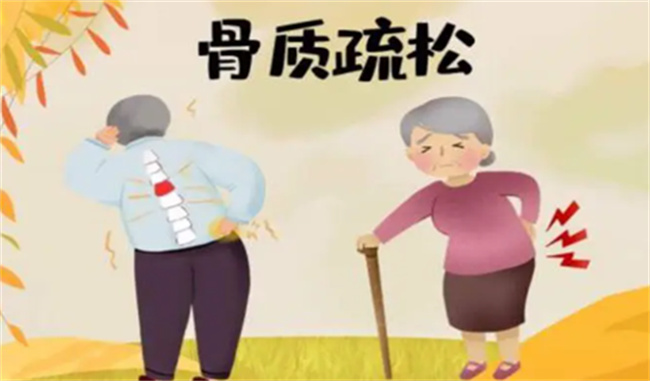 治疗骨质疏松最佳方法