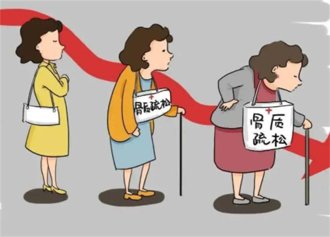 更年期骨质疏松症有哪些表现