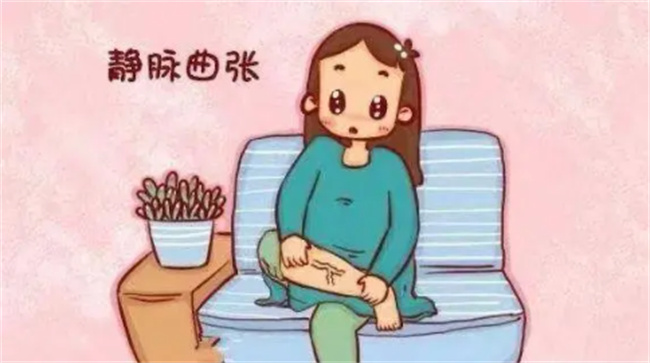 怎么能有效解决怀孕期间的静脉曲张