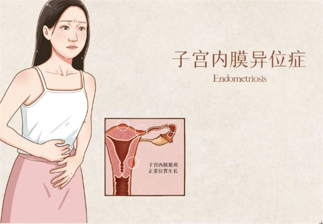 同房后出血：了解原因、治疗方法和预防措施