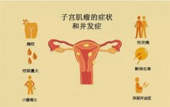子宫肌瘤是什么原因导致的