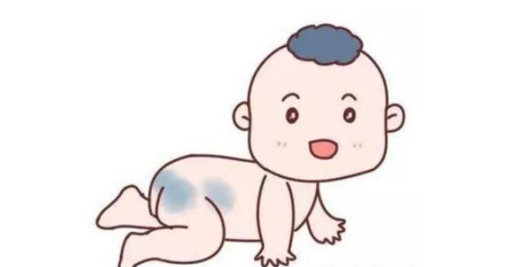 胎记形成原因解析:外部环境、生活习惯、遗传与营养的影响