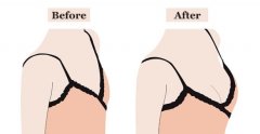 女性乳房发涨变大的原因及护理方法