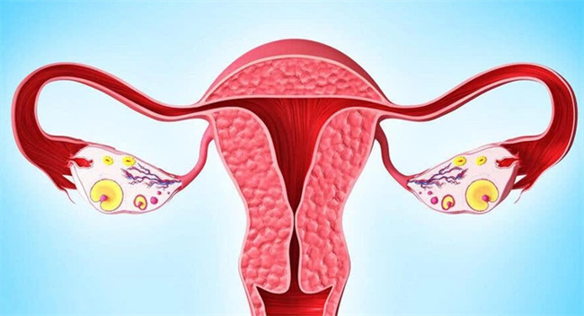深度解析子宫平滑肌肉瘤：症状、治疗与患者护理