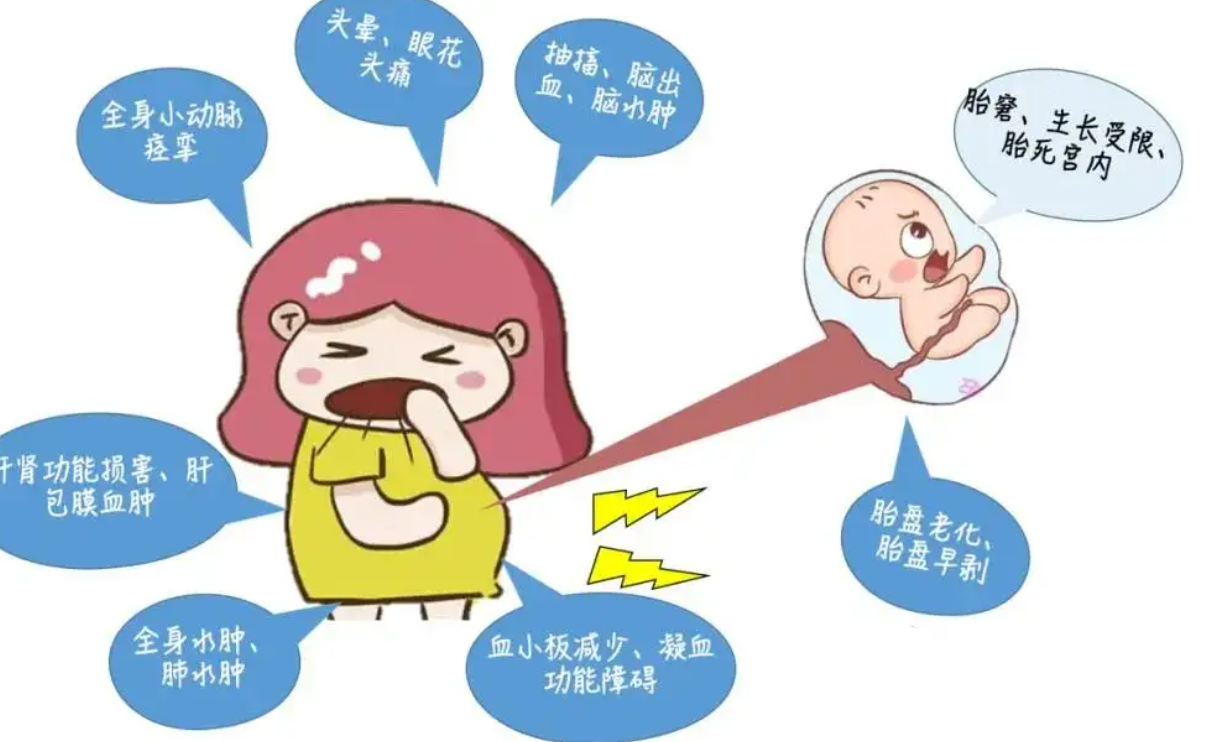【母亲群像】「再不剖就来不及了！到时要救妈妈还是救小孩？｣  子痫前症妈妈，心有余悸的产前产后21天