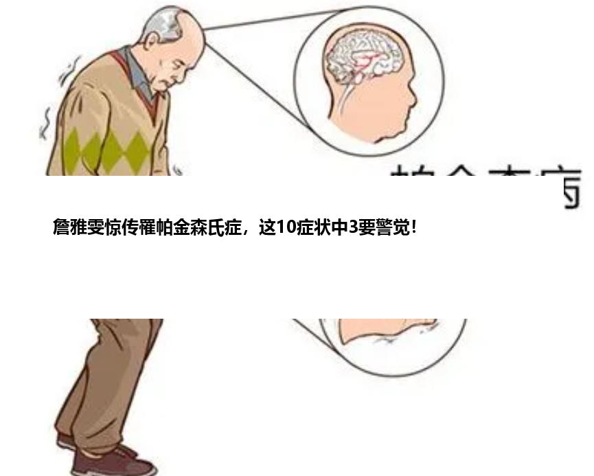 詹雅雯惊传罹帕金森氏症，这10症状中3要警觉！