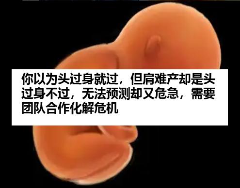 你以为头过身就过，但肩难产却是头过身不过，无法预测却又危急，需要团队合作化解危机