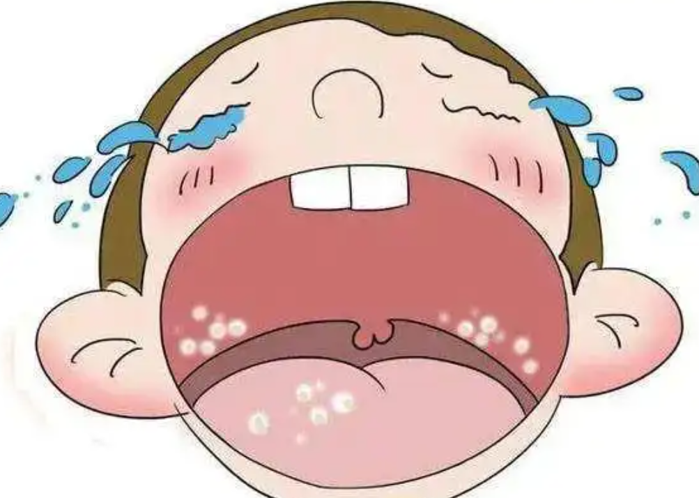 婴幼儿口腔溃疡为哪桩？不论物理性伤害或感染所致，都要小心照护，避免不吃不喝而脱水