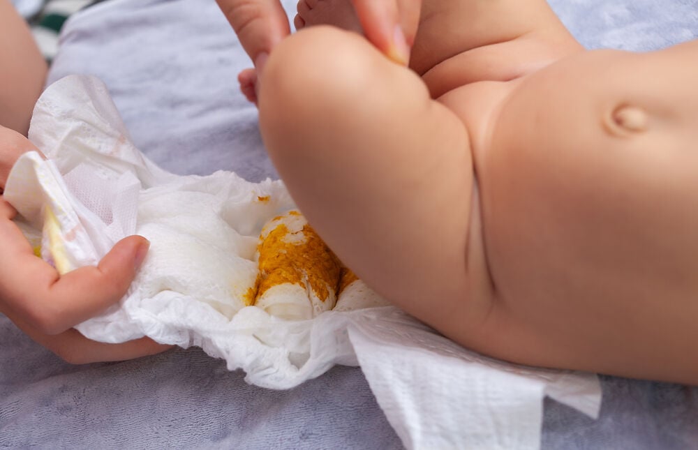 新生儿有黄色粘液: 正常还是异常?