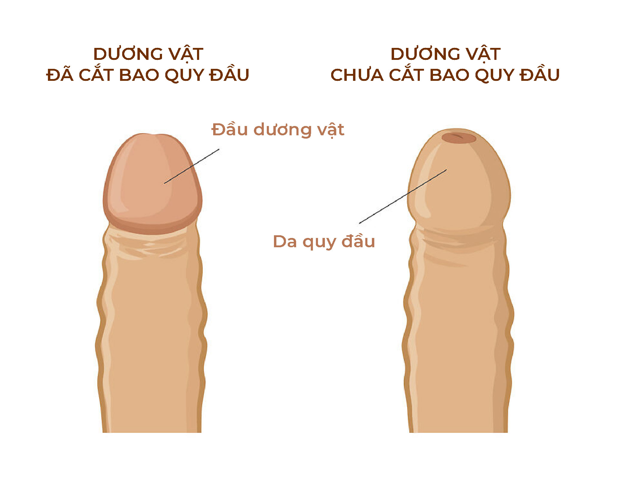 如何清洁新生男婴的生殖器