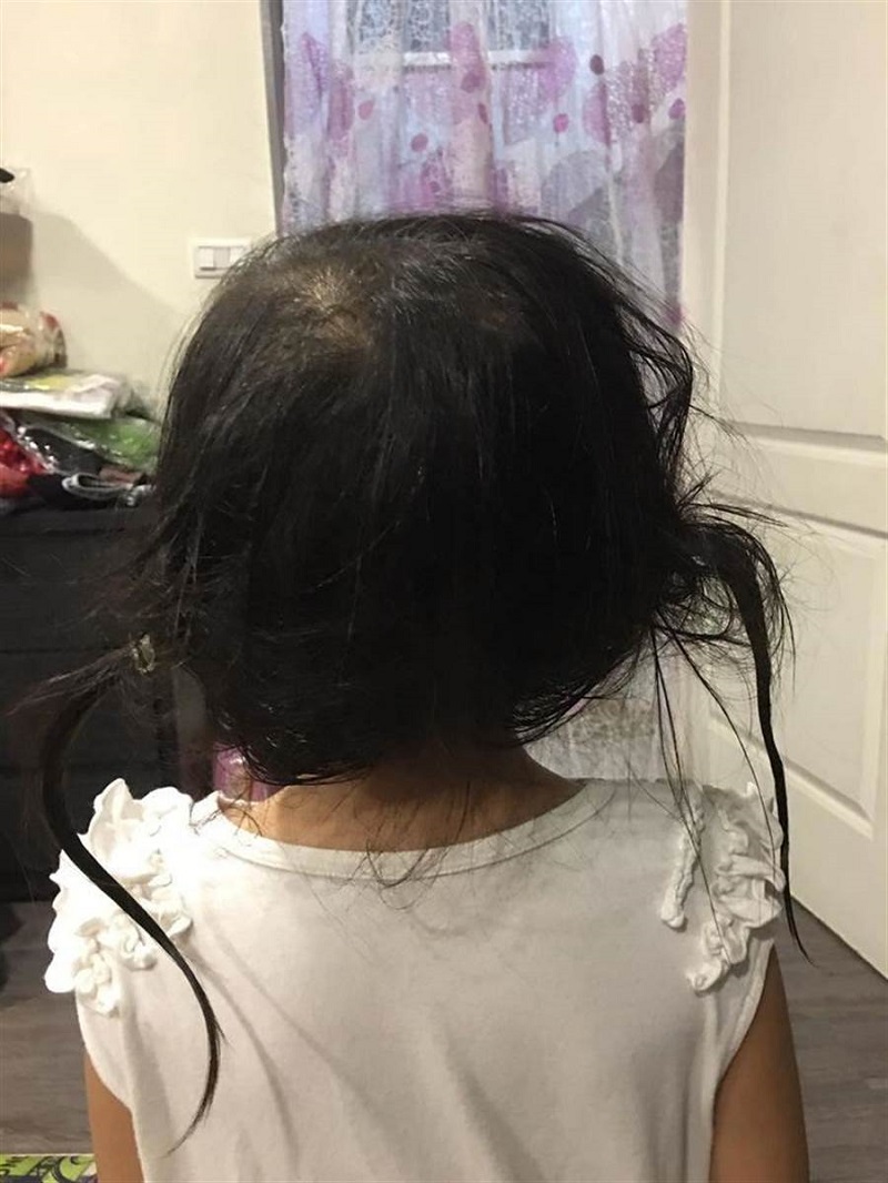 爸爸帮女儿洗头「橡皮筋没拆」悲剧,妈妈超傻眼