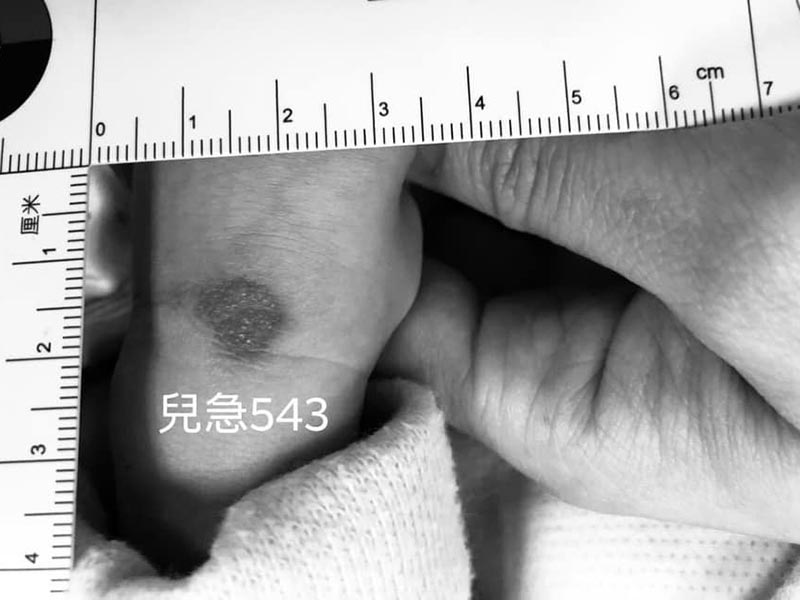 未满1岁遭虐，医师心寒曝：每月平均有5起，我们一定要帮孩子说话、发声！