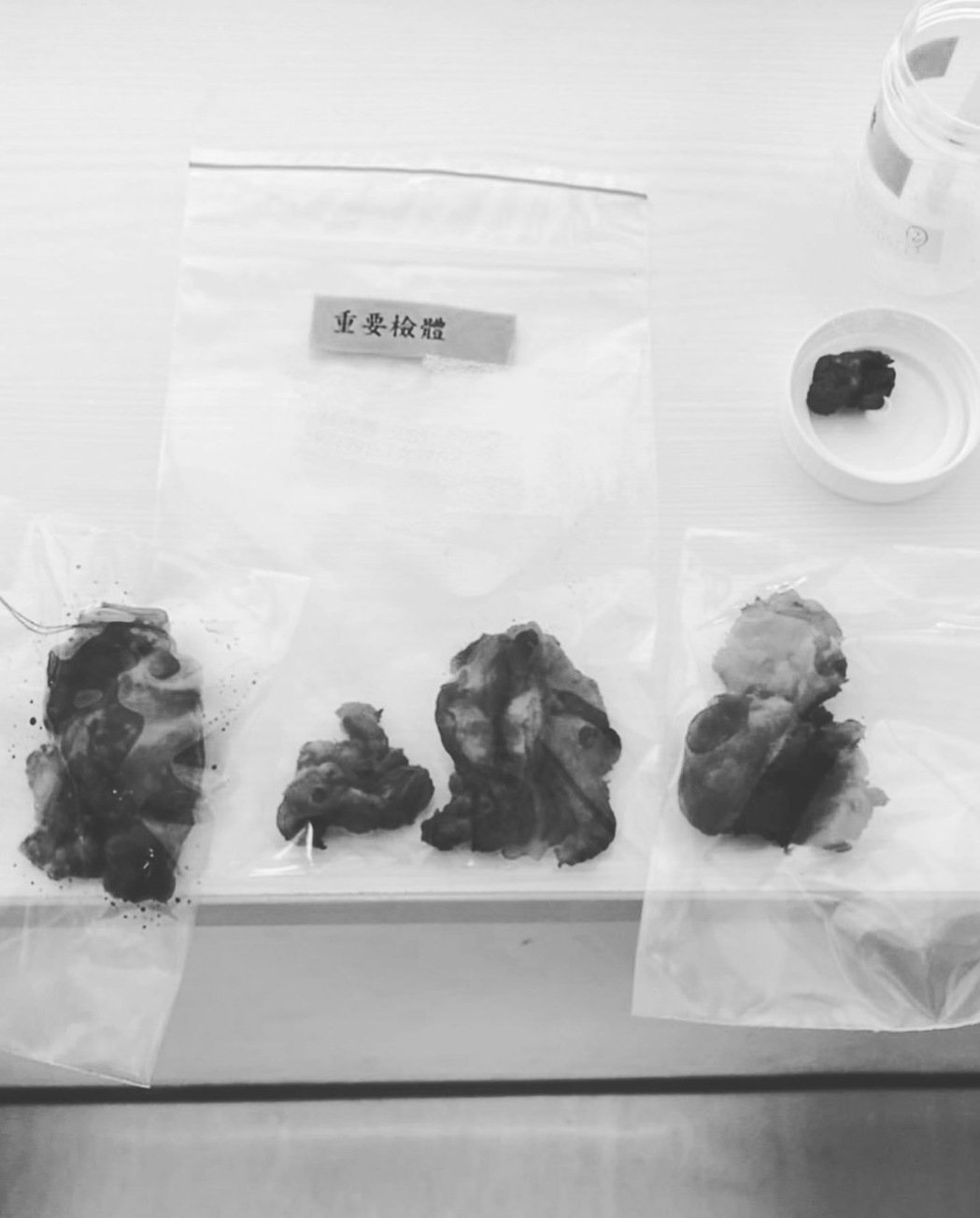 姐姐的朋友34岁女星无预兆罹癌呆站医院门爆哭：为什么是我？