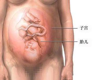 图解剖腹产全过程