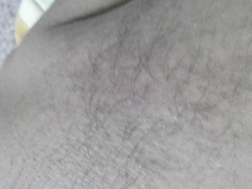 男人体毛多，性欲就强?