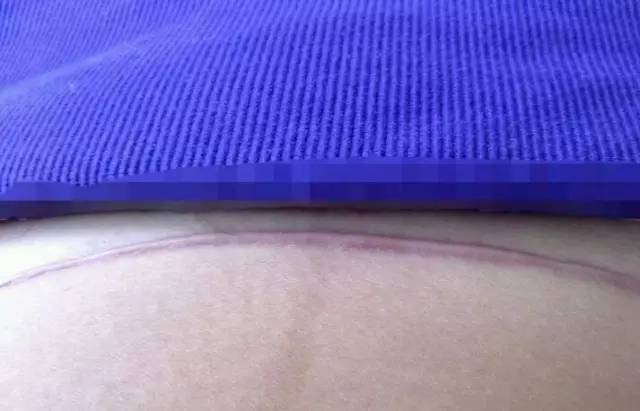 剖腹产妈妈看完这个3个瞬间，一定很佩服自己！