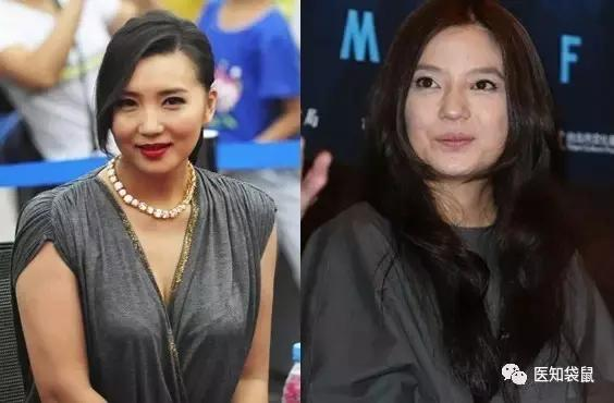 妇产科医生教你 产后快速瘦身:有效又不伤身!