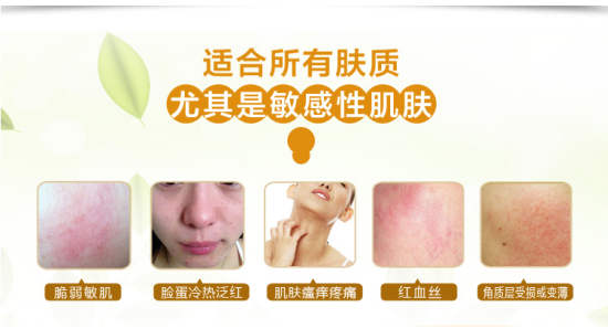 怎么能把过敏感肌 激素脸治好，修复脸肌首选欧丝丽曼