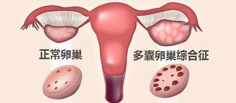 静医生说备孕：备孕一年多了，还没怀上怎么办？