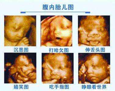 孕妈为什么一定要做四维彩超?否则后果会让你追悔莫及