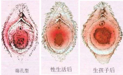 史上最真实的女人阴道图片