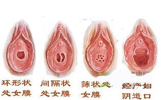 史上最真实的女人阴道图片
