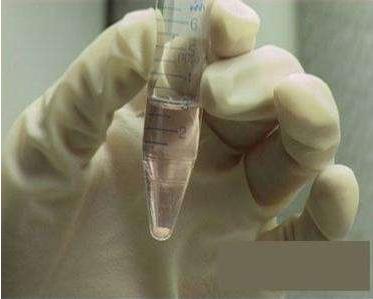人工受孕一次多少钱：人工受孕的过程及费用