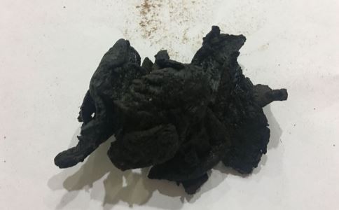 阴茎短小怎么办 推荐2个治疗方法