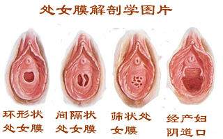 女性阴部真实照片：详解女人真实完美阴道图片【多图】
