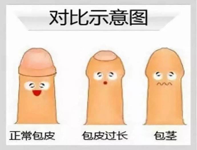 割包皮