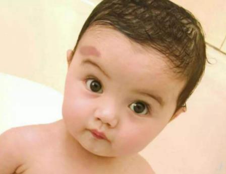 孕妇不能吃哪些食物 孕妇怎么防止孩子胎记