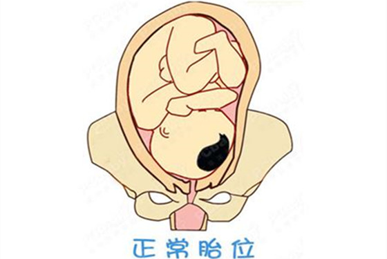 正常胎位是什么位傻傻分不清？五分钟教会你看胎位