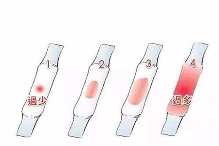月经量少是什么原因?女性经期出现这些毛病一定要懂得调理