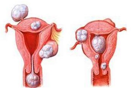 月经量少是什么原因?女性月经量少和这三点有关系