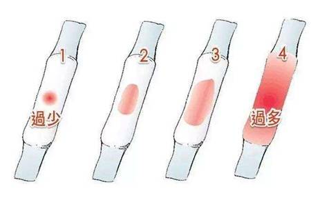月经量少是什么原因?调理女性月经不调的方法