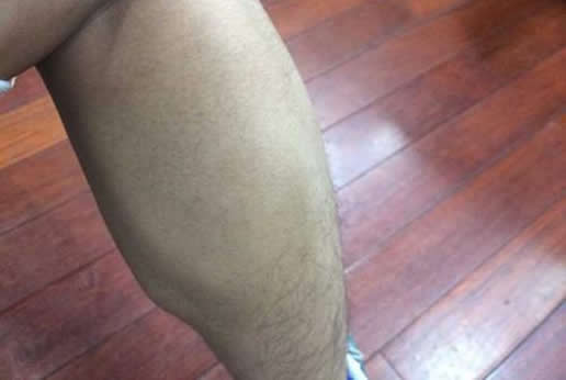 什么样腿是萝卜腿图片：分享8个有效瘦腿运动