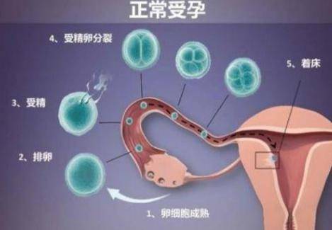 影响女性受孕的4个因素，宫颈口太小会影响怀孕吗？