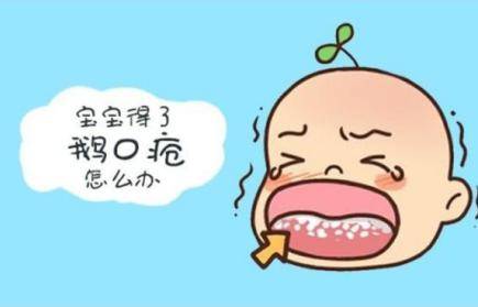 宝宝鹅口疮反复发作怎么办?2个鹅口疮最佳治疗方法