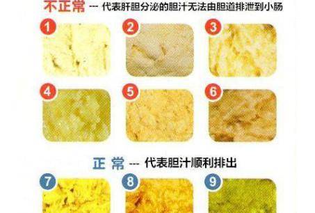 宝宝拉屎有奶瓣是怎么回事?为什么会有这种情况